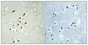 14 - GCP5 Polyclonal Antibody AP70064