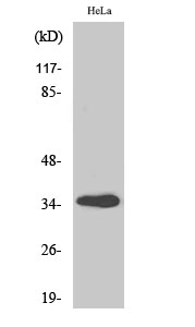 1 - GIMAP5 Polyclonal Antibody AP70088