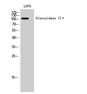 1 - Glucosidase IIα Polyclonal Antibody AP70101
