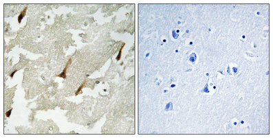 14 - GRIN2 Polyclonal Antibody AP70243