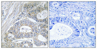 14 - GRIN2 Polyclonal Antibody AP70243