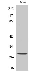 1 - GSTT1/4 Polyclonal Antibody AP70267