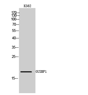 1 - GUSBP1 Polyclonal Antibody AP70272