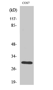 1 - HCCS Polyclonal Antibody AP70290