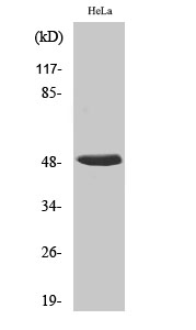 1 - hnRNP H Polyclonal Antibody AP70384