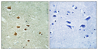 14 - HoxA11/D11 Polyclonal Antibody AP70393