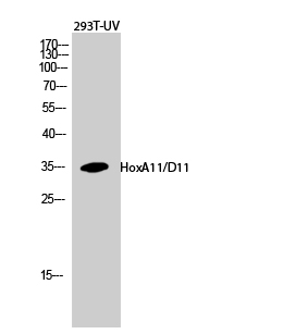 1 - HoxA11/D11 Polyclonal Antibody AP70393