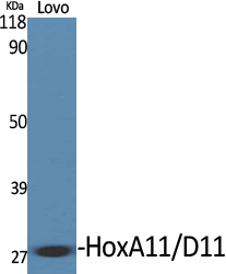 1 - HoxA11/D11 Polyclonal Antibody AP70393