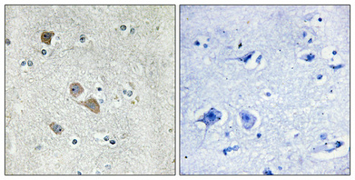 1 - IFI-56K Polyclonal Antibody AP70458