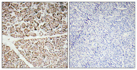 14 - IGF-I Polyclonal Antibody AP70471