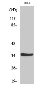 1 - IL-20Rβ Polyclonal Antibody AP70509