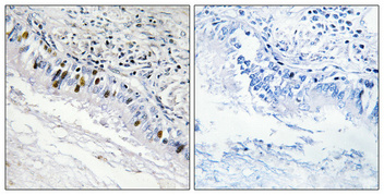 14 - InsP 3-kinase C Polyclonal Antibody AP70537