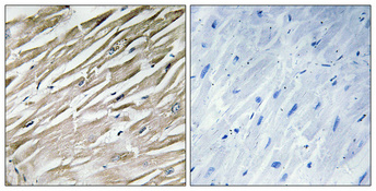 1 - IPP-2 Polyclonal Antibody AP70569