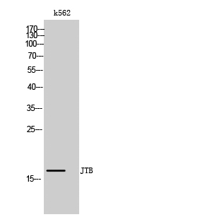 1 - JTB Polyclonal Antibody AP70627
