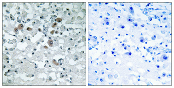 14 - KDEL Receptor 3 Polyclonal Antibody AP70646