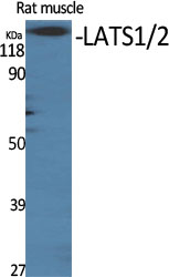 1 - LATS1/2 Polyclonal Antibody AP70726