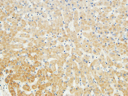 14 - LBP Polyclonal Antibody AP70727