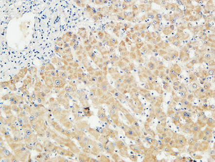 14 - LBP Polyclonal Antibody AP70727