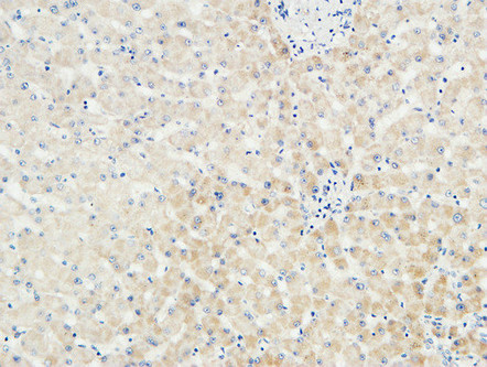 14 - LBP Polyclonal Antibody AP70727