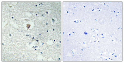 14 - LDOC1L Polyclonal Antibody AP70736