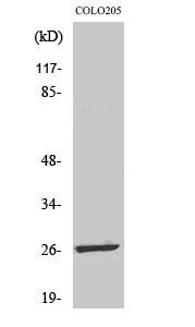 1 - LDOC1L Polyclonal Antibody AP70736