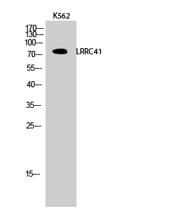 1 - LRRC41 Polyclonal Antibody AP70776