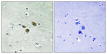14 - ME3 Polyclonal Antibody AP70878