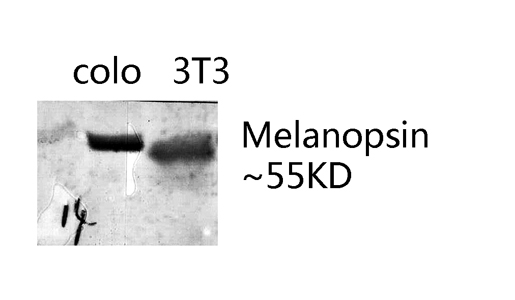 1 - Melanopsin Polyclonal Antibody AP70912