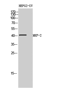 1 - MKP-2 Polyclonal Antibody AP70956