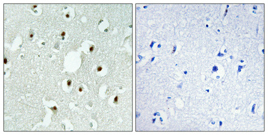 1 - MLH3 Polyclonal Antibody AP70964