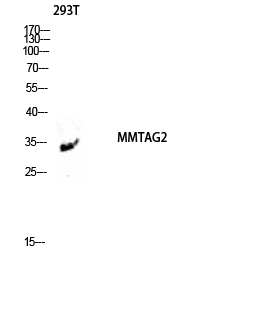1 - MMTAG2 Polyclonal Antibody AP70984