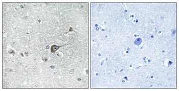 14 - MRP-L20 Polyclonal Antibody AP71035