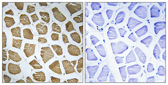 14 - MRP-S22 Polyclonal Antibody AP71064