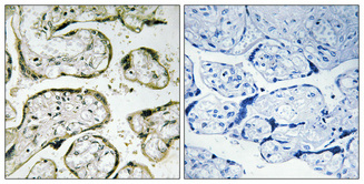 14 - MRP-S32 Polyclonal Antibody AP71069