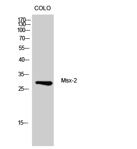 1 - Msx-2 Polyclonal Antibody AP71088