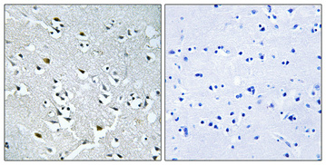 14 - N4BP1 Polyclonal Antibody AP71145