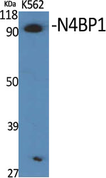 1 - N4BP1 Polyclonal Antibody AP71145