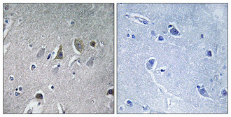 14 - NDUFV2 Polyclonal Antibody AP71205