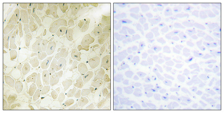 14 - p164-RhoGEF Polyclonal Antibody AP71677