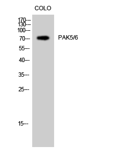 1 - PAK5/6 Polyclonal Antibody AP71757