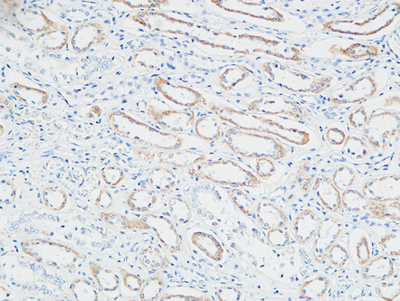 1 - PBF Polyclonal Antibody AP71792