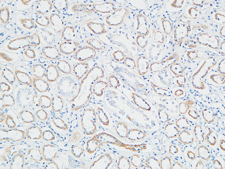 14 - PBF Polyclonal Antibody AP71792