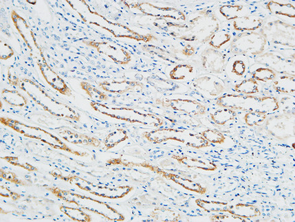 14 - PBF Polyclonal Antibody AP71792