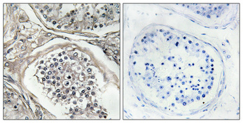 14 - PI 3-kinase p85α/γ Polyclonal Antibody AP71896