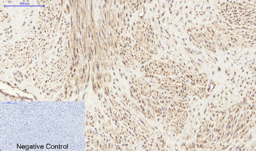 14 - PI 3-kinase p85α/γ Polyclonal Antibody AP71896