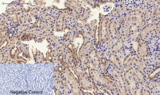 14 - PI 3-kinase p85α/γ Polyclonal Antibody AP71896