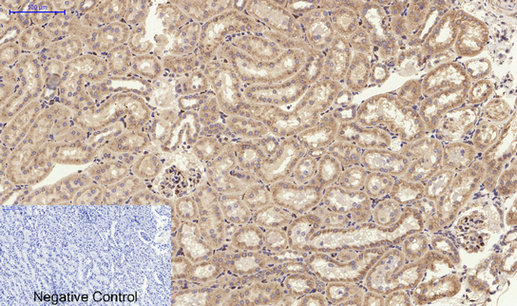 14 - PI 3-kinase p85α/γ Polyclonal Antibody AP71896