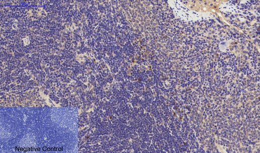 14 - PI 3-kinase p85α/γ Polyclonal Antibody AP71896