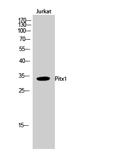 1 - Pitx1 Polyclonal Antibody AP71923