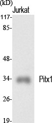 1 - Pitx1 Polyclonal Antibody AP71923